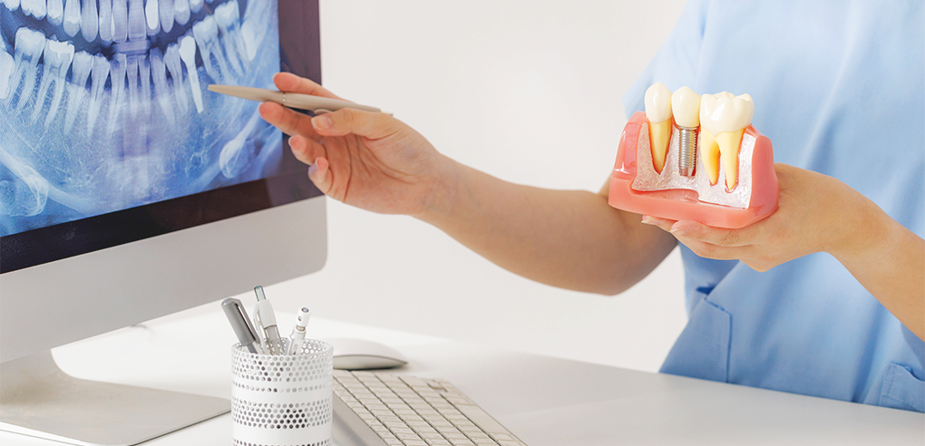 HAESEONG DENTAL CLINIC|임플란트 치료