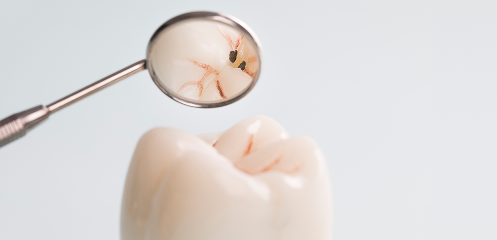 HAESEONG DENTAL CLINIC|충치치료