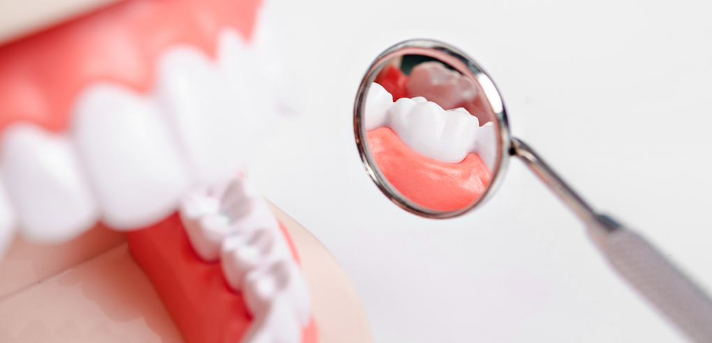 HAESEONG DENTAL CLINIC|치아미백 치료